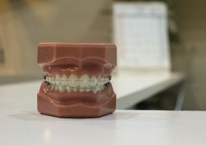 a dentists denture model