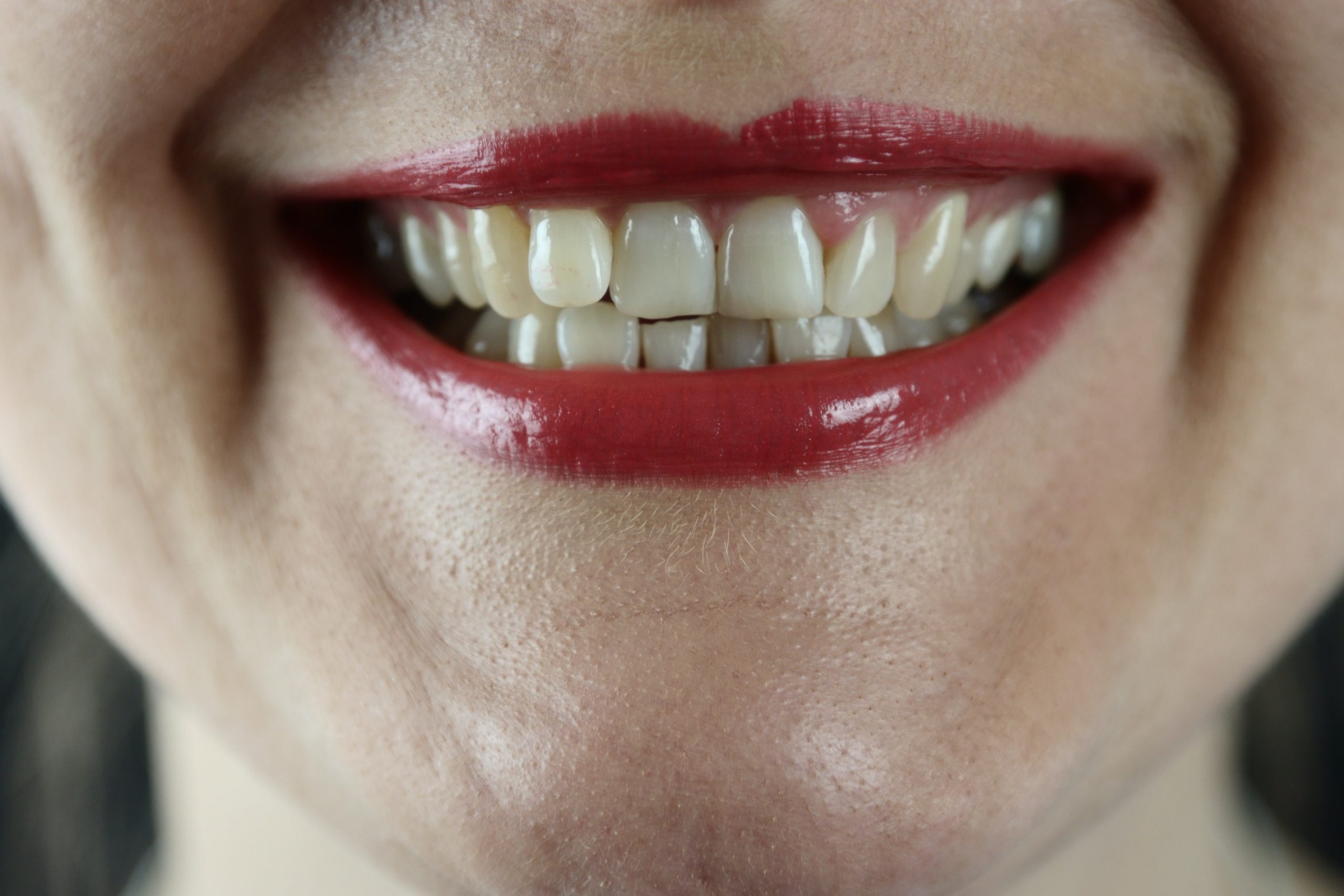 A smiling set of teeth
