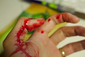 A bloodied hand...