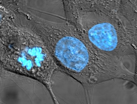 cells undergoing interphase