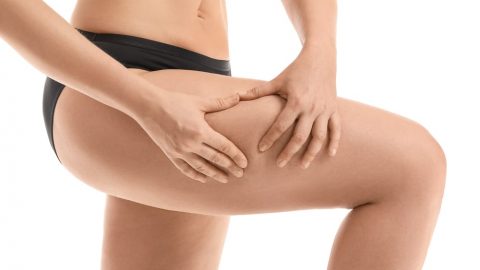 Facts About Cellulite